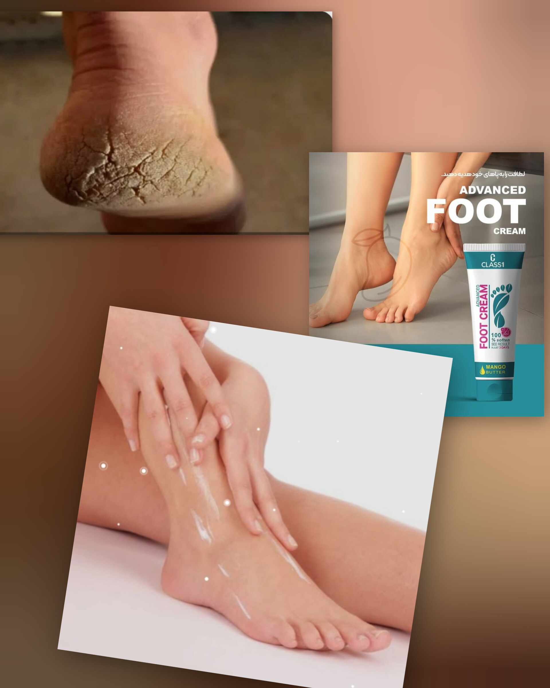 کرم پا برای ترک و خشکی پاشنه پا؛ چطور پاهایی نرم و سالم داشته باشیم