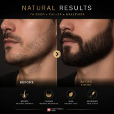 روغن تقویت ریش آقایان تراست ۳۰ میلیلیتر